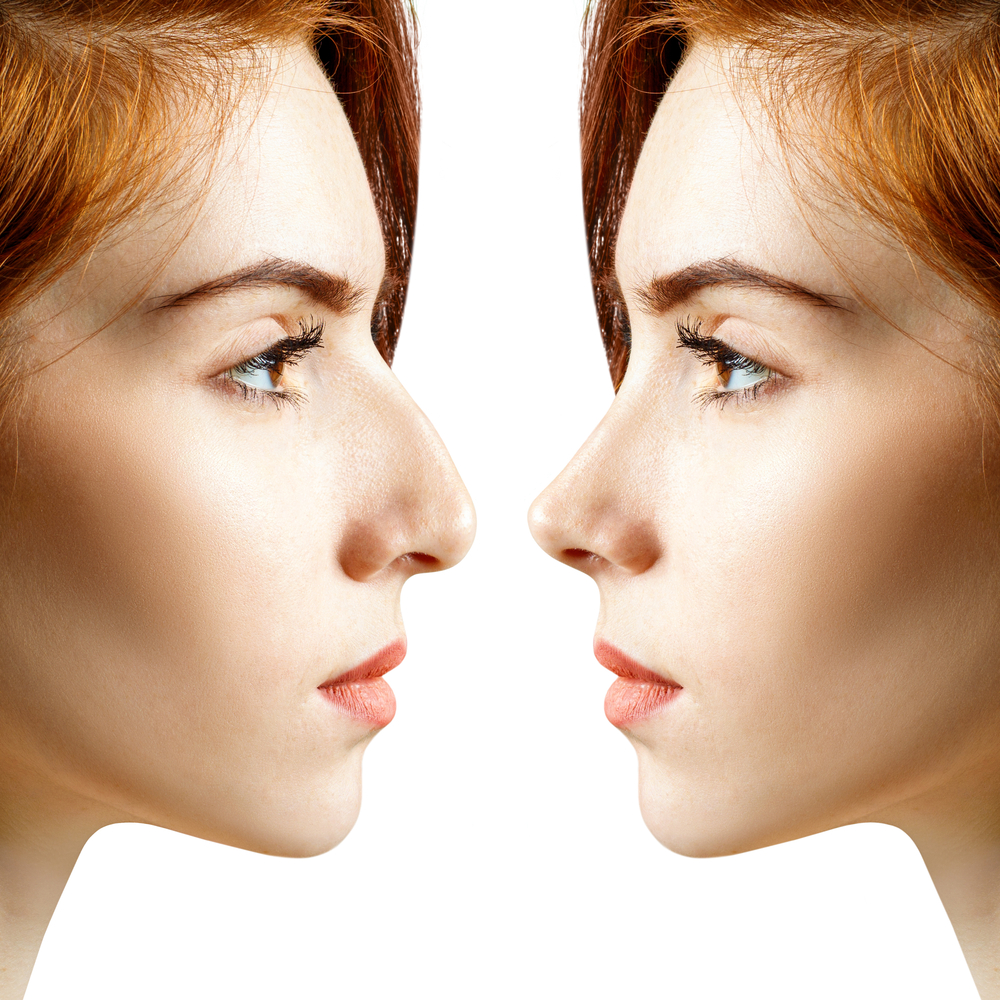 What Is the Best Age for Getting Rhinoplasty? Boulder CO - Boulder Plastic  Surgery